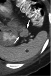 Fig. 12