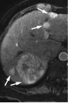 Fig. 19