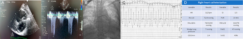 FIG 2