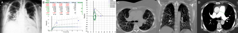 FIG 1