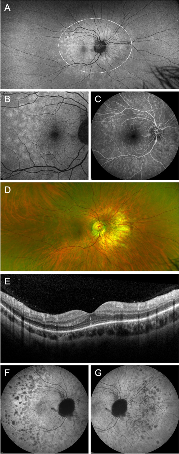 Fig. 3