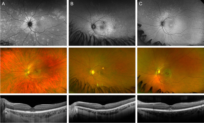 Fig. 1