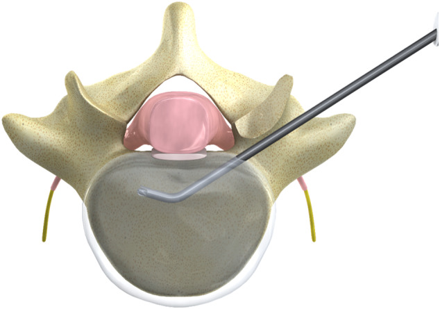 Fig. 2