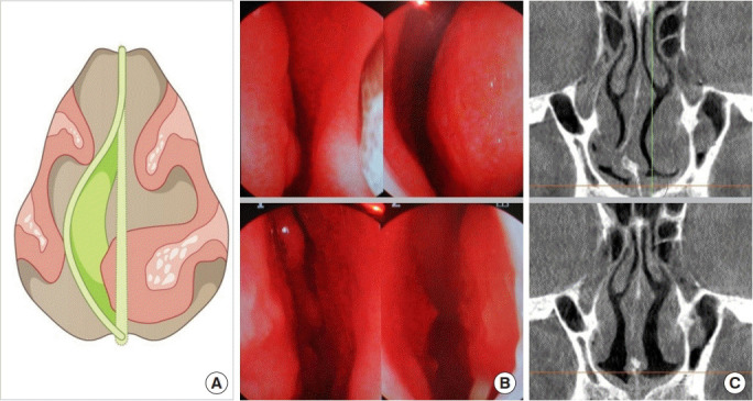 Fig. 19.