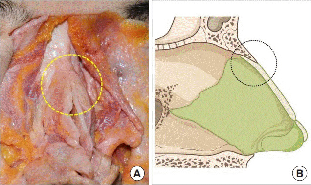 Fig. 12.