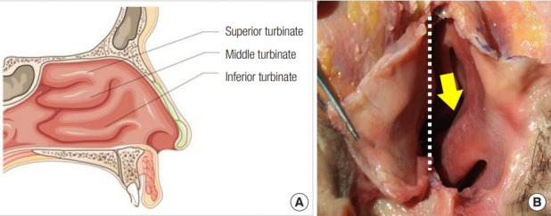 Fig. 17.