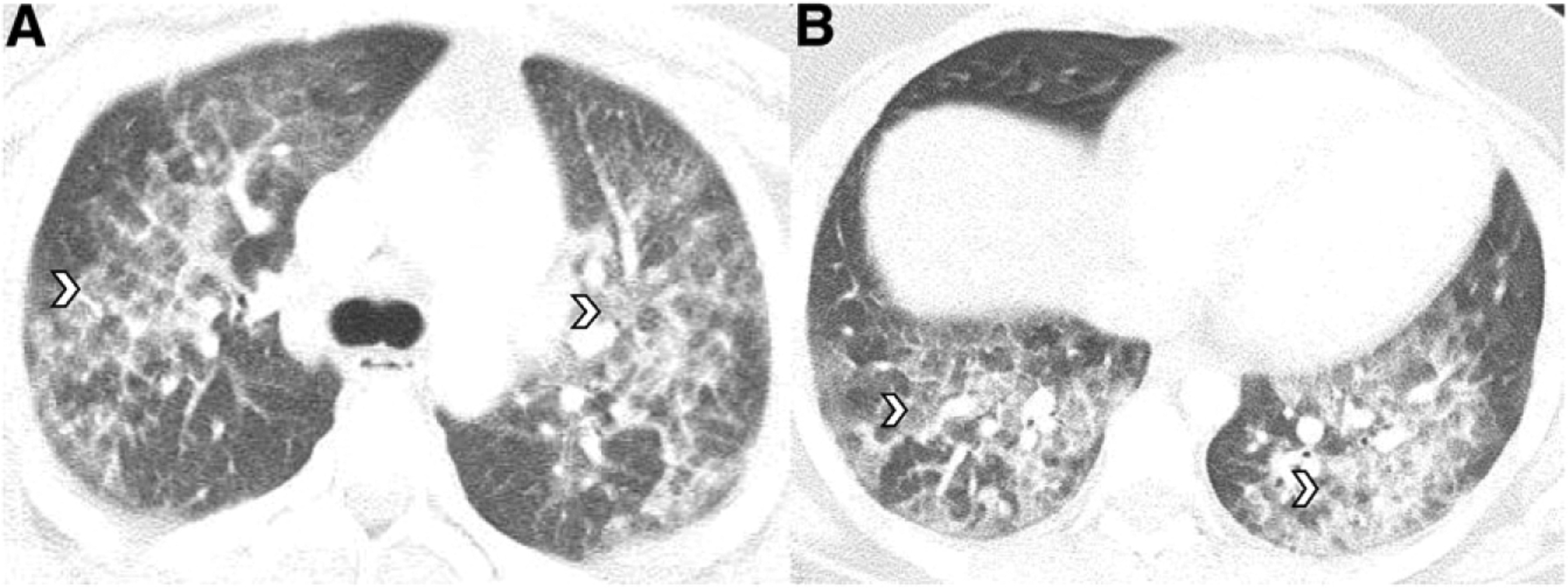 FIGURE 3