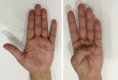 Fig. 10