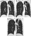 Fig. 25