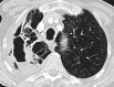 Fig. 24