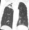 Fig. 29