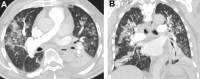Fig. 13