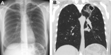 Fig. 21
