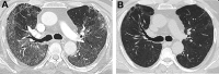 Fig. 7