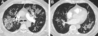Fig. 10