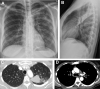 Fig. 18
