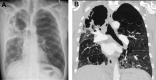 Fig. 27