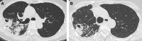 Fig. 26