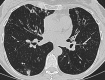 Fig. 23