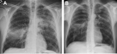 Fig. 17