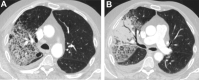 Fig. 16