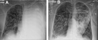 Fig. 19