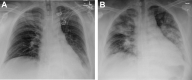 Fig. 15