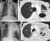Fig. 28