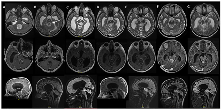 Figure 2