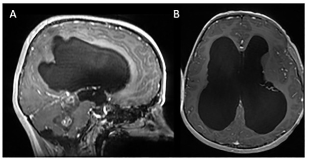 Figure 1