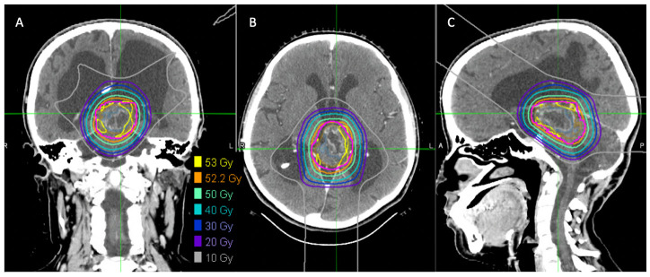 Figure 3