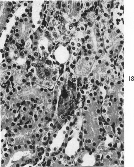 Fig. 18