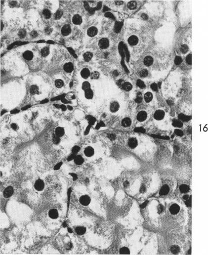 Fig. 16