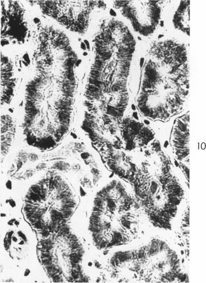 Fig. 10