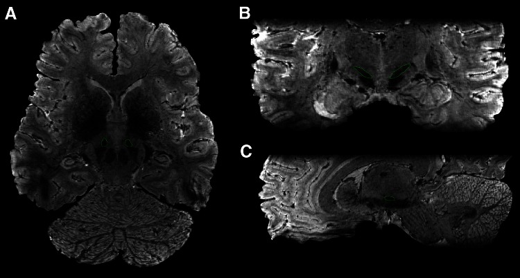 Fig. 3