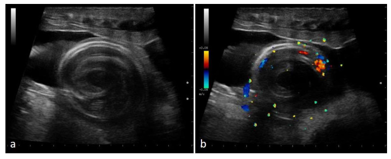 Figure 15