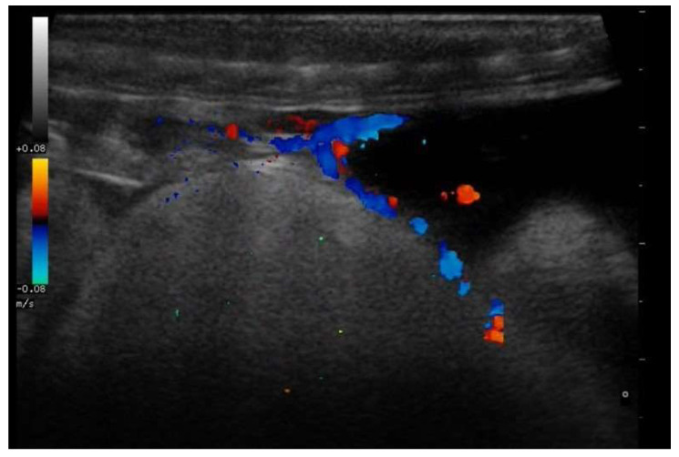 Figure 13