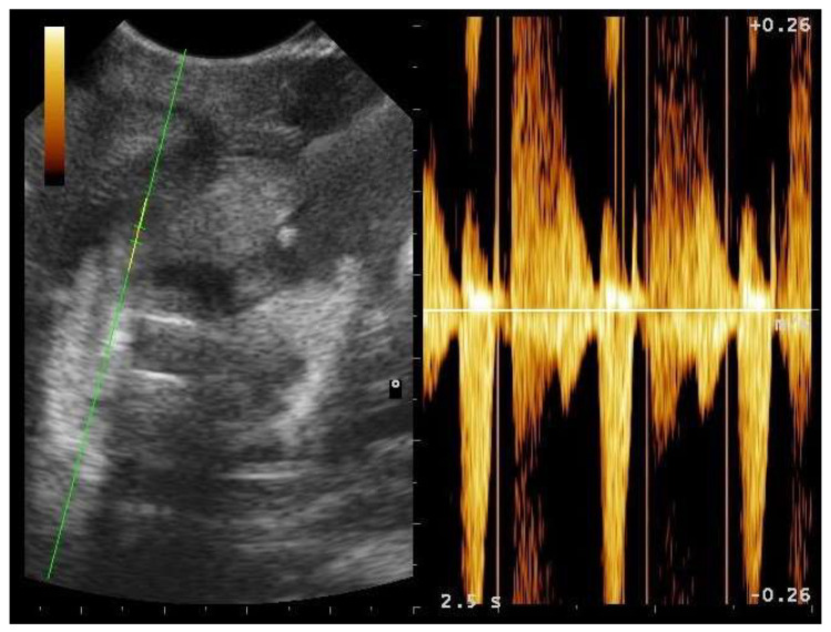 Figure 17