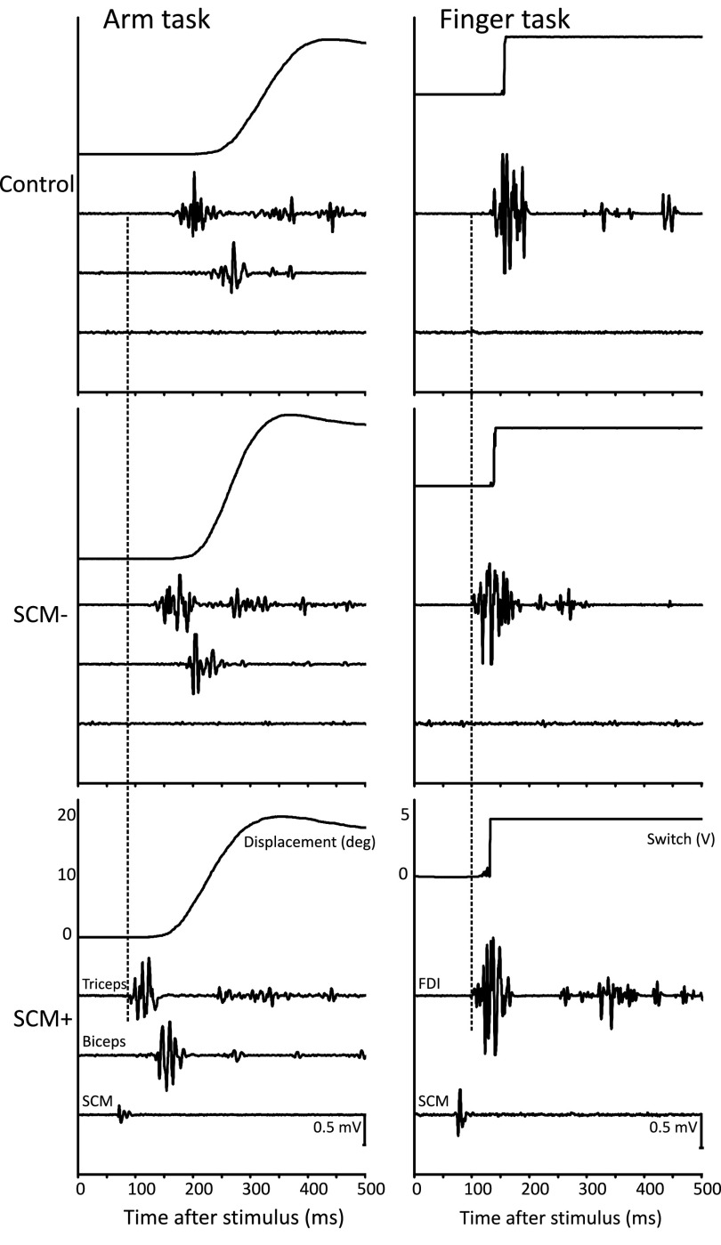 FIG. 2.