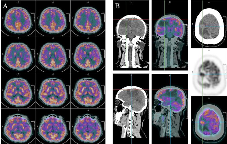 Figure 2