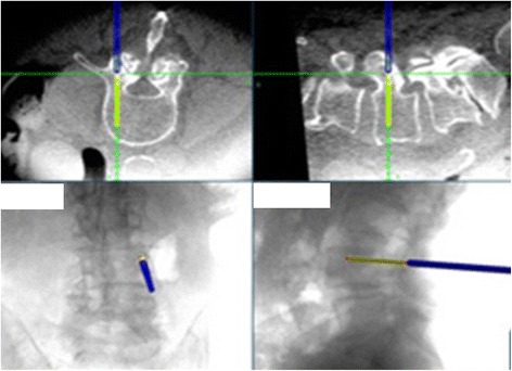 Fig. 4