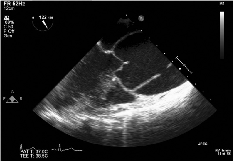 Figure 1: