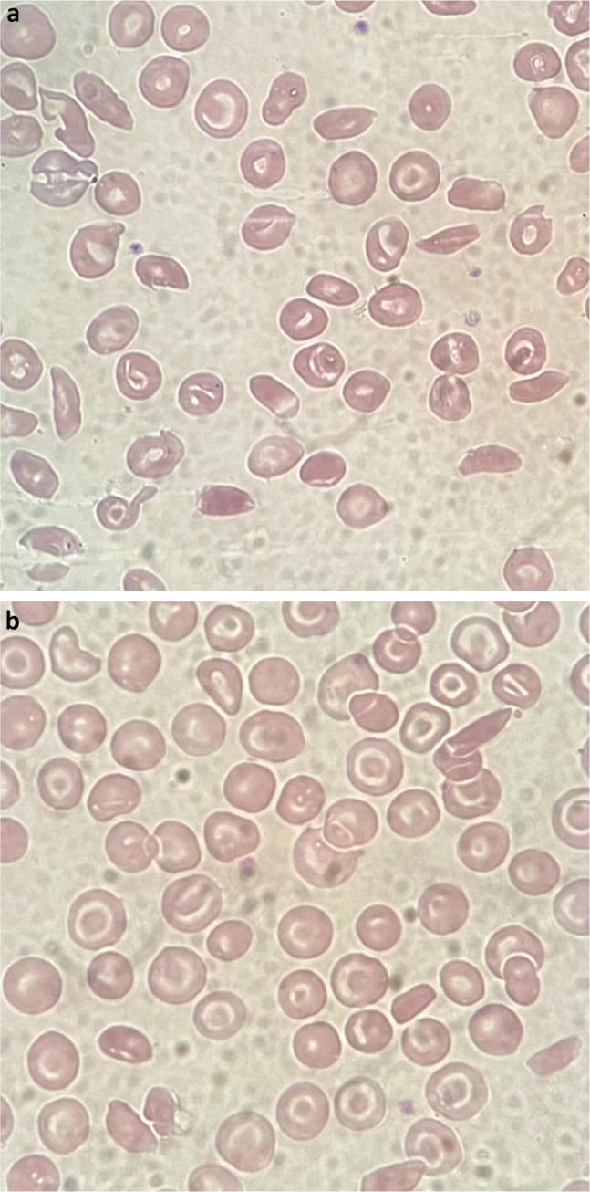 Fig 1.