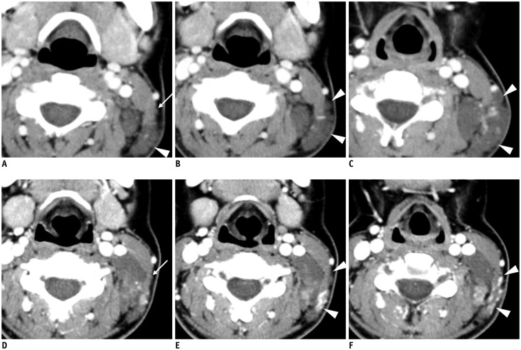 Fig. 11