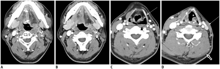 Fig. 20