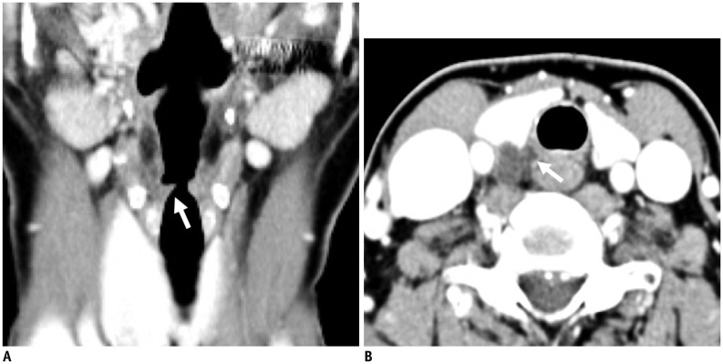 Fig. 17