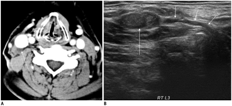 Fig. 13