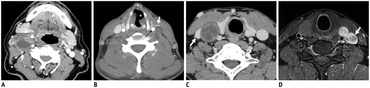 Fig. 16