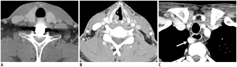 Fig. 18