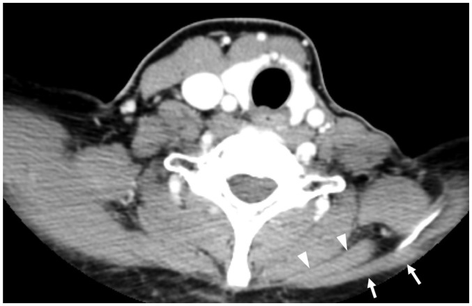 Fig. 19